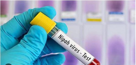 Nipah Virus