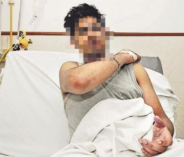 Injured Student