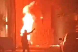 Amritsar Burn